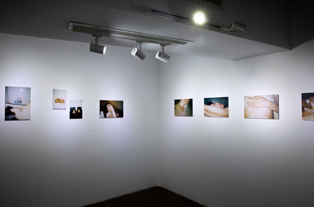 MẮT BÉT